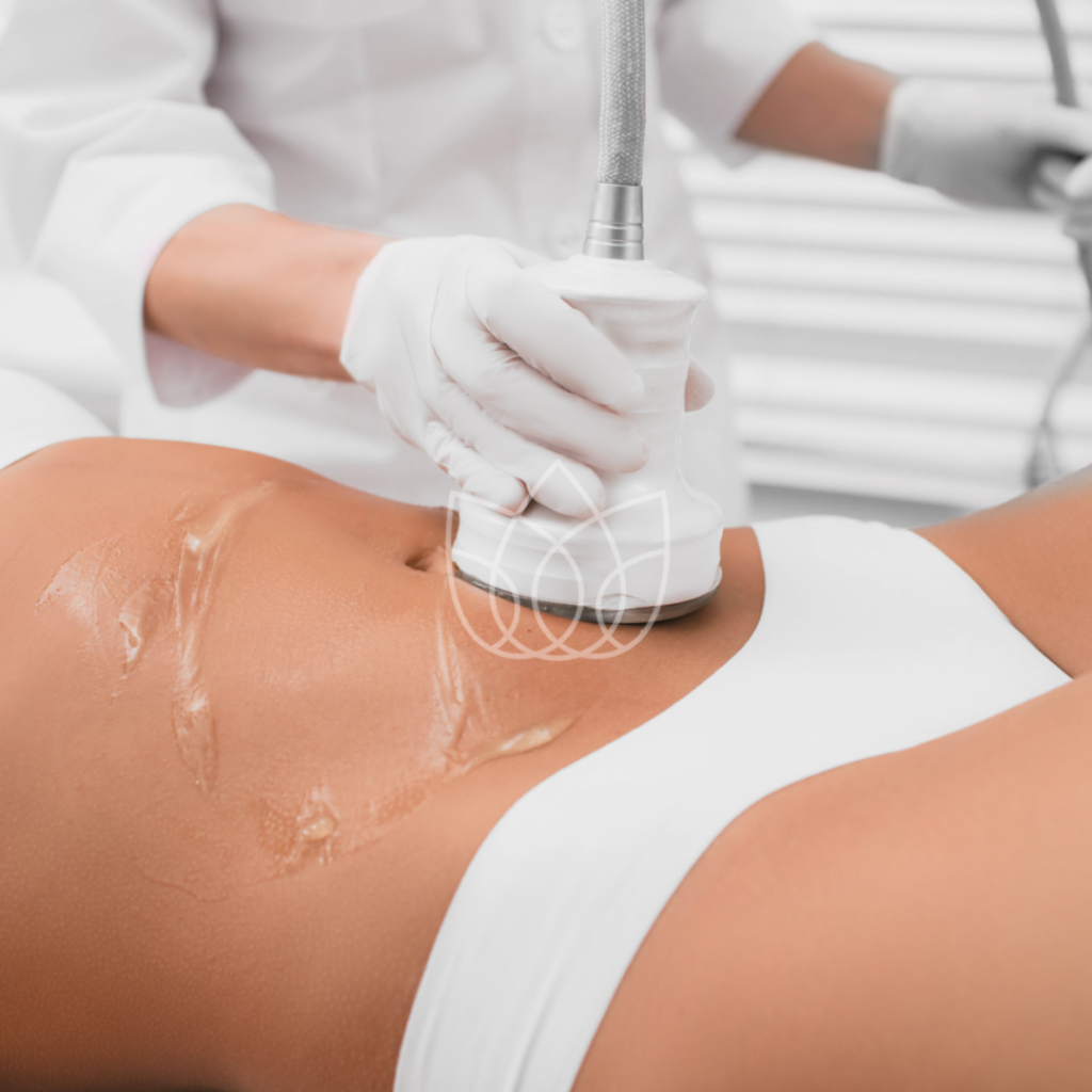 Lipo Cavitation​