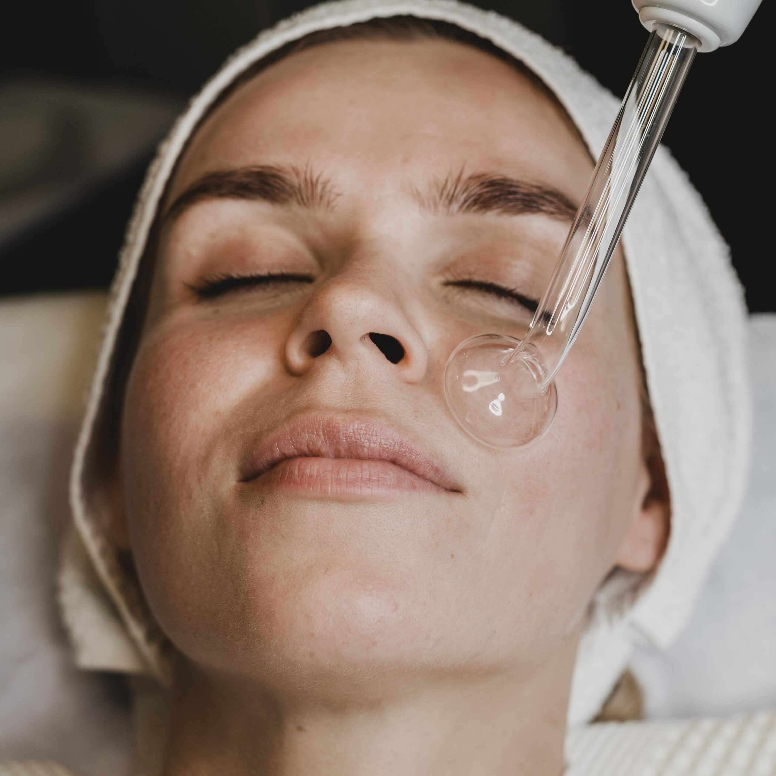 CHEMICAL PEELS