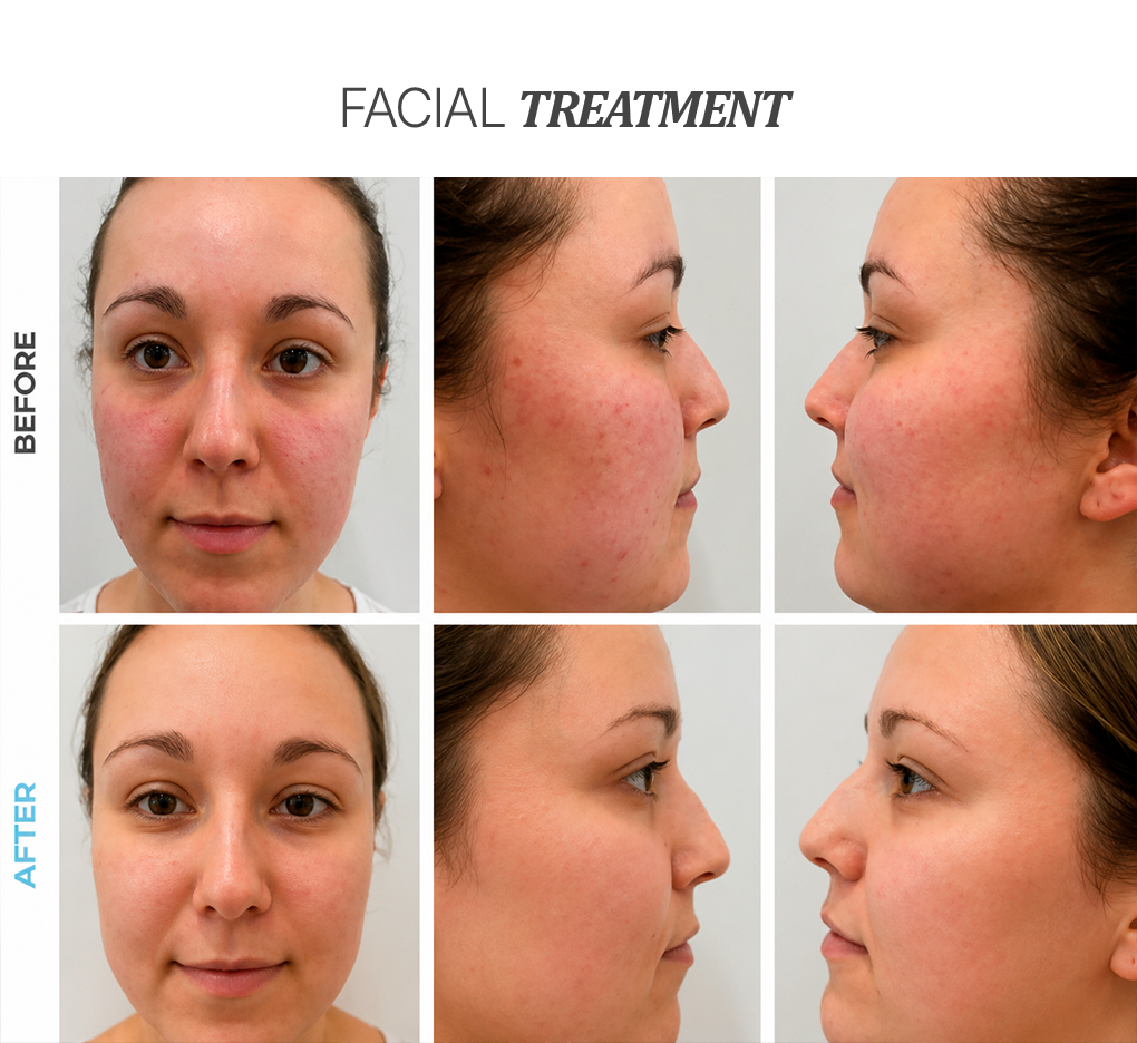 facial-treatment