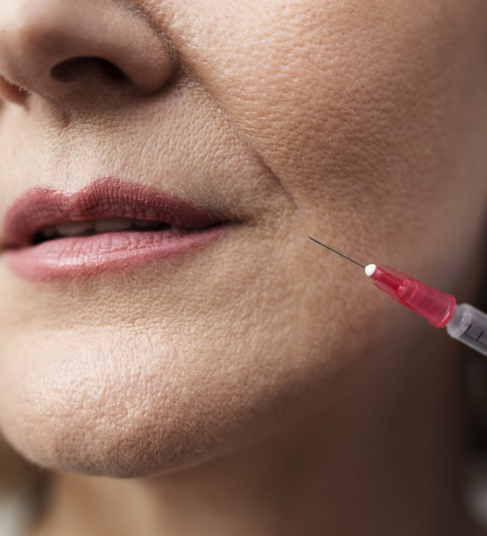 close-up-smiley-woman-with-hyaluronic-acid-injection close-up-smiley-woman-with-hyaluronic-acid-injection