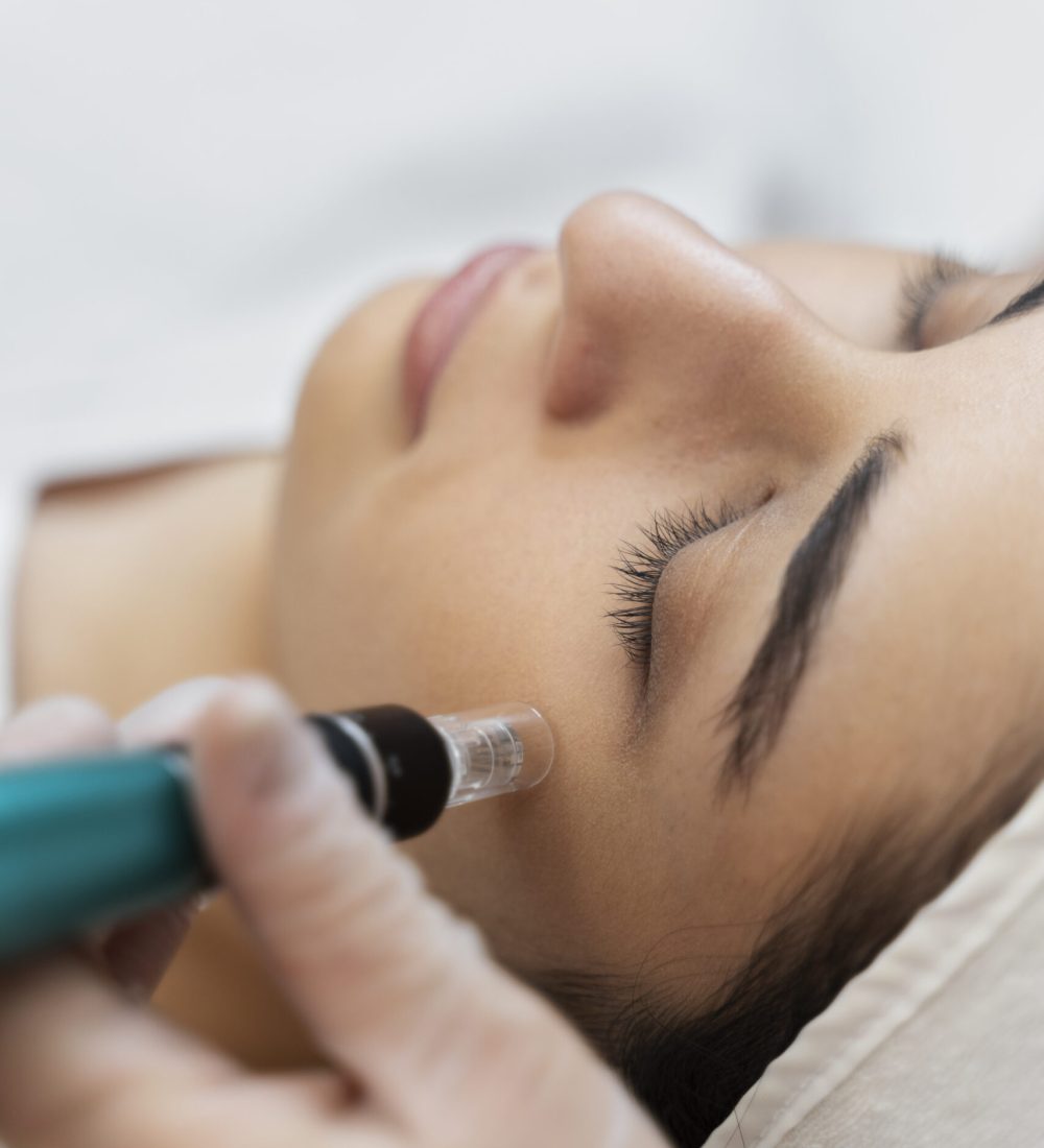 person-getting-micro-needling-beauty-treatment person-getting-micro-needling-beauty-treatment